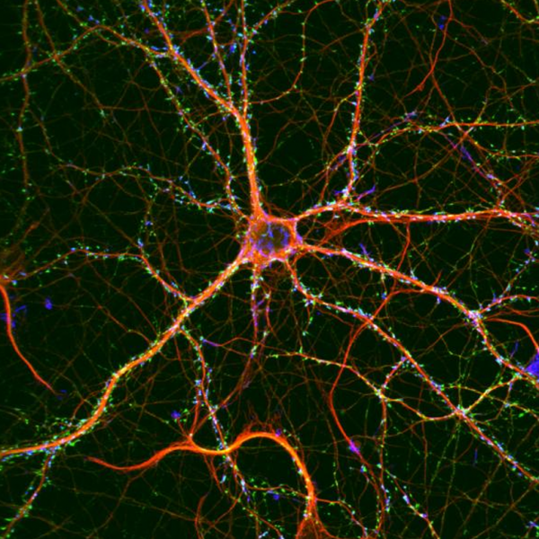 Optogenetics - 89 North